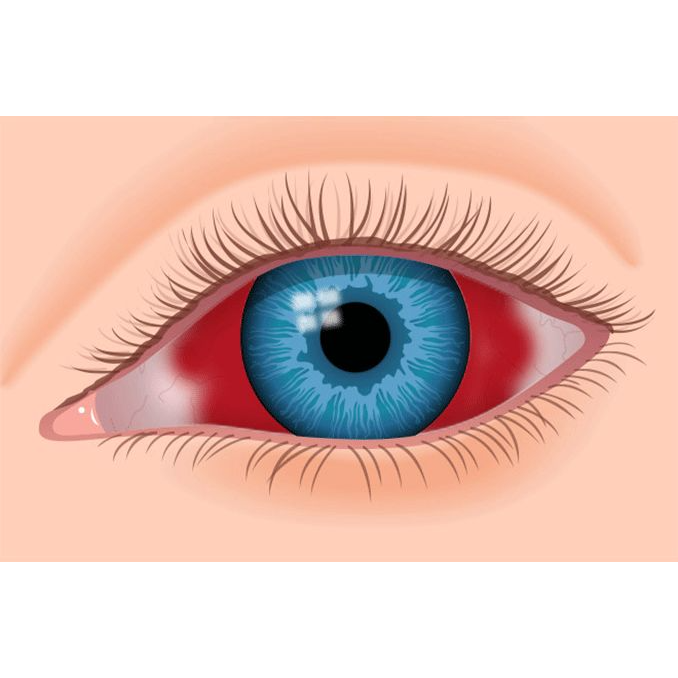 bleeding eyes logo